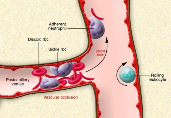 Camber Pharma推出仿制药Captopril